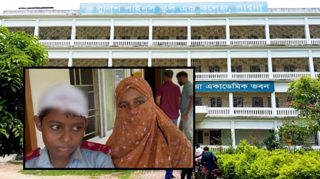 ক্লাস চলাকালে শিক্ষার্থীর মাথায় খুলে পড়লো চলন্ত ফ্যান