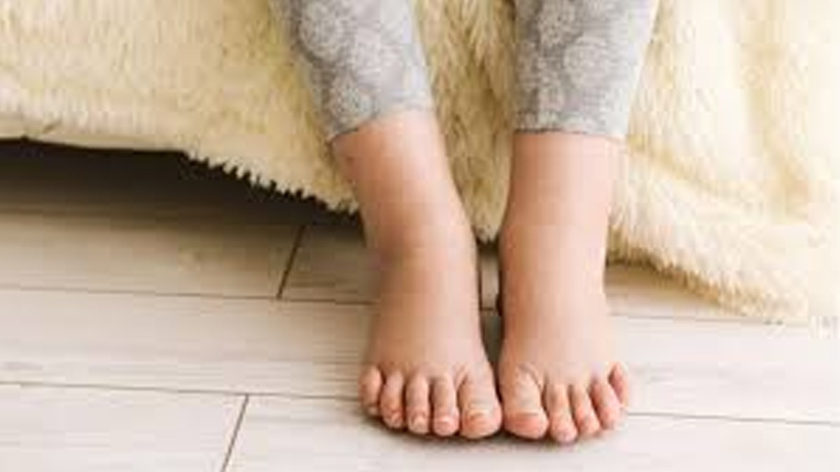 ঈদ যাত্রায় যানজট, দীর্ঘক্ষণ বসে থাকার ফলে পা ফুলে গেলে করণীয়