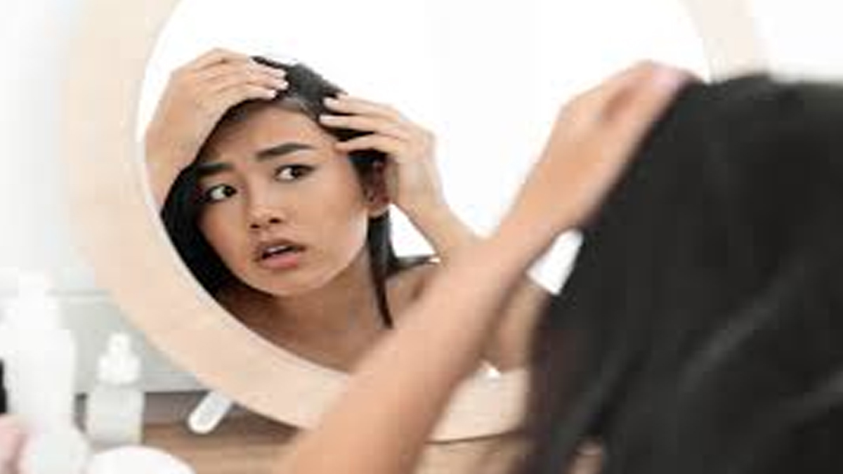 ‘ডিএইচটি হেয়ার লস’ আসলে কী, জেনে নিন