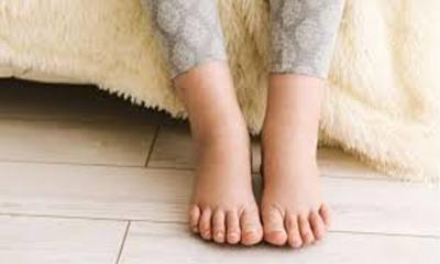 ঈদ যাত্রায় যানজট, দীর্ঘক্ষণ বসে থাকার ফলে পা ফুলে গেলে করণীয়